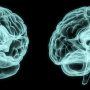 Breathe Press Release Submission - Hemispheric NeuroAI Model Wants To Make Brain Health Measurable